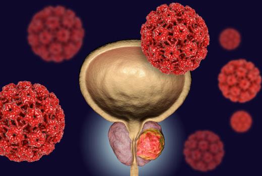 2025 ASCO：他拉唑帕尼 + 恩杂鲁胺，延长 mCRPC 生存期