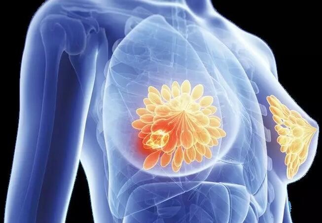 Itovebi (inavolisib)：PIK3CA 突变乳腺癌治疗新希望