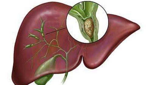 福巴替尼常见副作用解析，患者用药需知